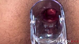 Mature Anal Gaping with Speculum 😏