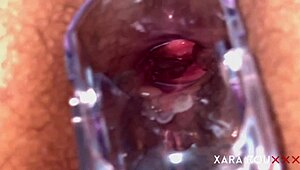 Mature Anal Gaping with Speculum 😏