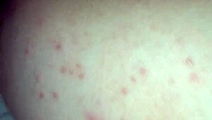 Moja Sylwia My Girlfriend Handjob Outdoor With Friend